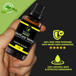 VARICURE VIENS - thewonderhealing